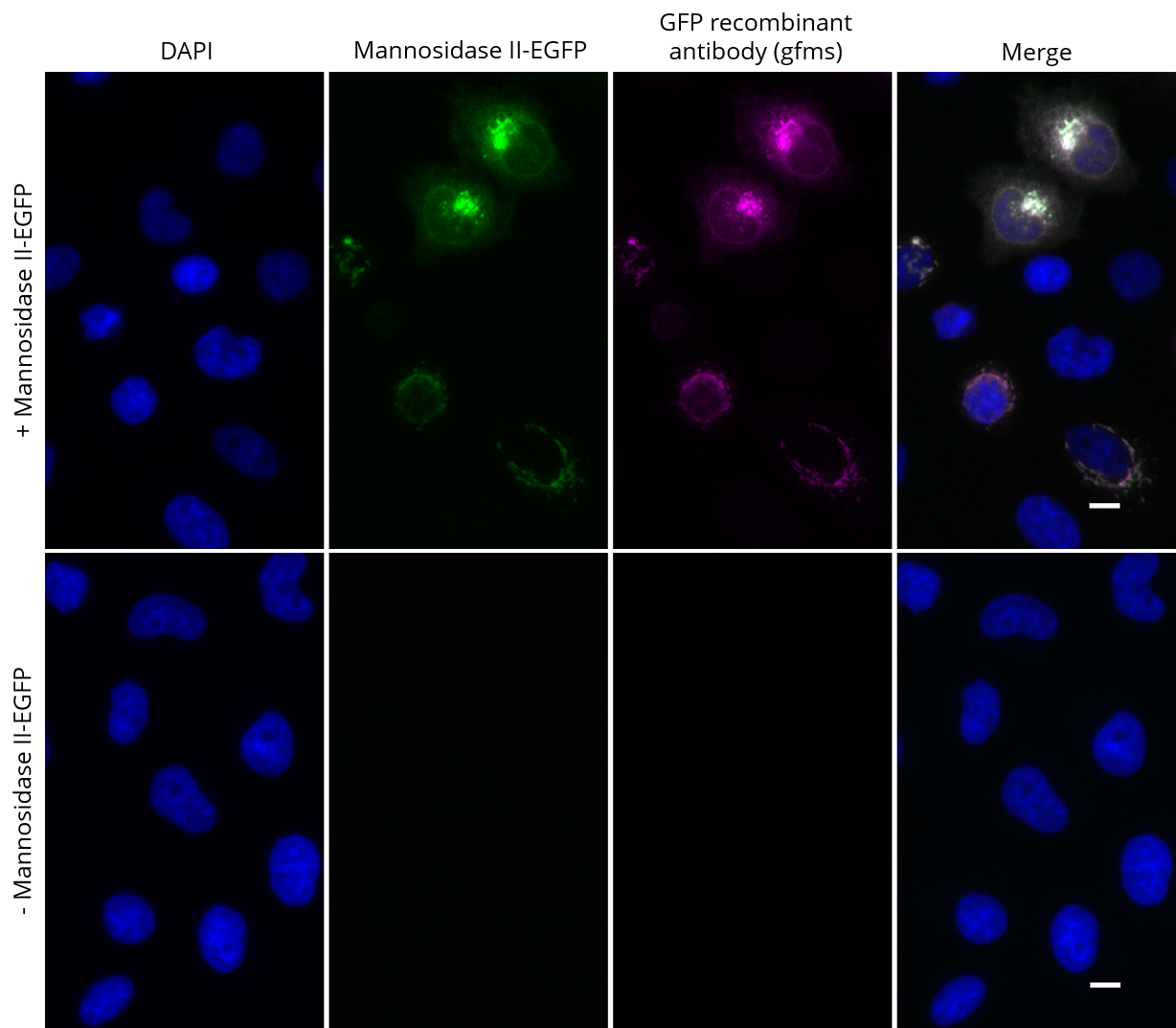 HeLa cells transiently expressing Mannosidase II-EGFP were immunostained with GFP recombinant antibody, VHH-mouse IgG1 Fc fusion [CTK0201] (gfms, 1:2,000) and Nano-Secondary® alpaca anti-mouse IgG1, recombinant VHH, Alexa Fluor® 647 [CTK0103, CTK0104] (sms1AF647-1, 1:500). Scale bar, 10 µM.