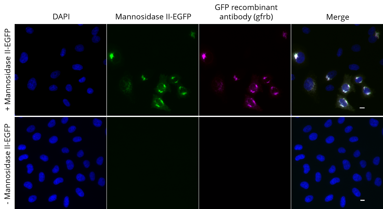 HeLa cells transiently expressing Mannosidase II-EGFP were immunostained with GFP recombinant antibody, VHH-rabbit IgG Fc fusion [CTK0201] (gfrb-20, 1:1,000) and Nano-Secondary® alpaca anti-human IgG/anti-rabbit IgG, recombinant VHH, Alexa Fluor® 647 [CTK0101, CTK0102] (srbAF647-1, 1:1,000). Scale bar, 10 µM.