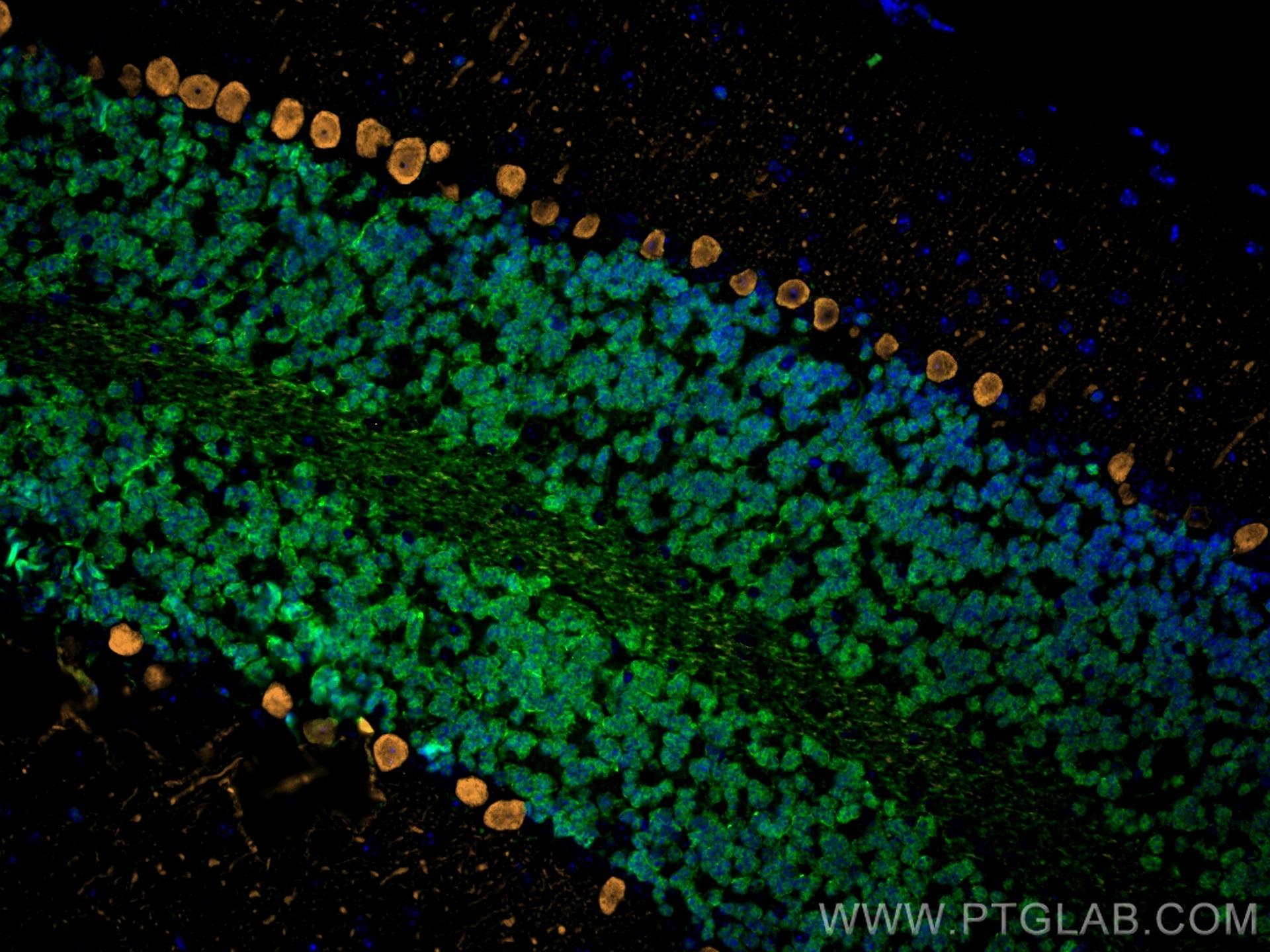マウス小脳組織切片を用いたNeuNとCalbindin-D28kの免疫蛍光染色（IF）結果
