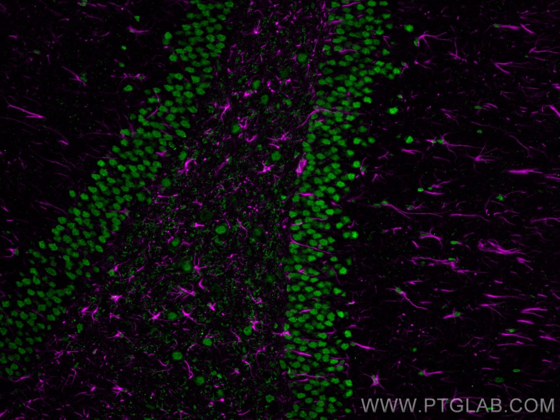 ラット脳切片を用いたGFAPとNeuNの免疫蛍光染色（IF）結果