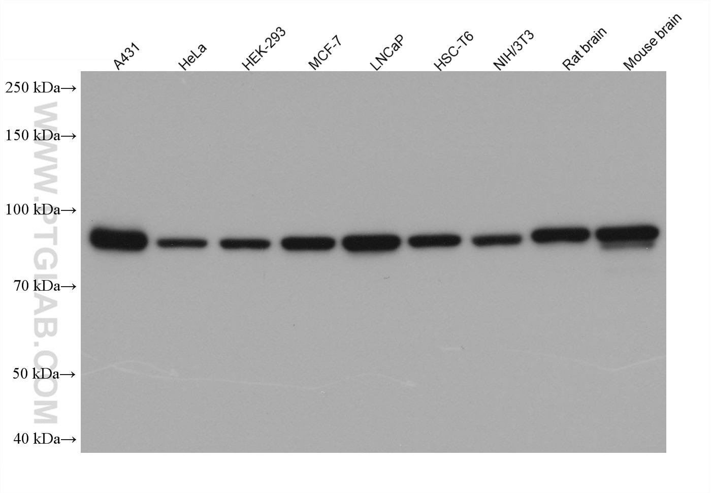 様々なライセートの抗ウサギIgG二次抗体を用いた化学発光ウェスタンブロット（WB）結果