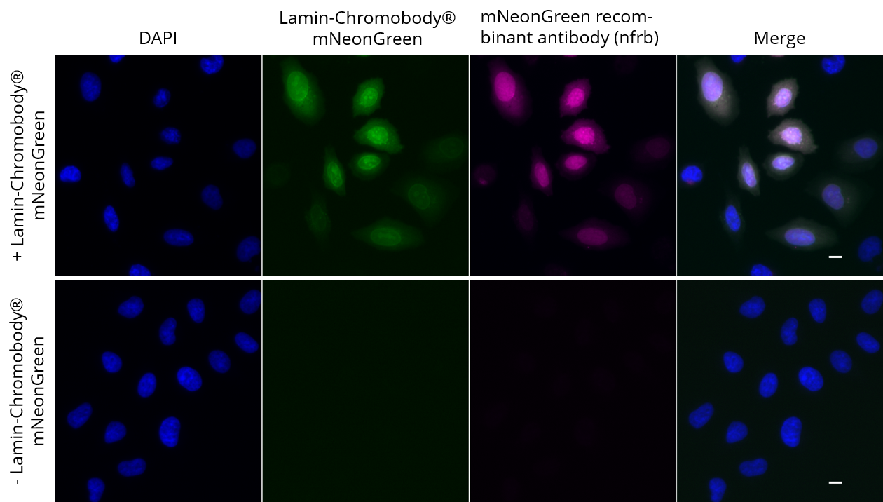 HeLa cells transiently expressing Lamin-Chromobody®-mNeonGreen were immunostained with mNeonGreen recombinant antibody, VHH-rabbit IgG Fc fusion [CTK0203] (nfrb, 1:1,000) and Nano-Secondary® alpaca anti-human IgG/anti-rabbit IgG, recombinant VHH, Alexa Fluor® 647 [CTK0101, CTK0102] (srbAF647-1, 1:1,000). Scale bar, 10 µM.