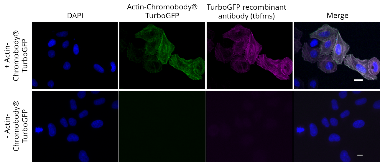 HeLa cells transiently expressing Actin-Chromobody®-TurboGFP were immunostained with TurboGFP recombinant antibody, VHH-mouse IgG1 Fc fusion [CTK0204] (tbfms, 1:400) and Nano-Secondary® alpaca anti-mouse IgG1, recombinant VHH, Alexa Fluor® 647 [CTK0103, CTK0104] (sms1AF647-1, 1:500). Scale bar, 10 µM