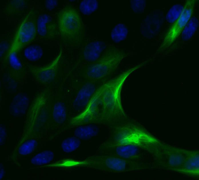 Vimentin-Chromobody visualizes Vimentin filaments in live cells