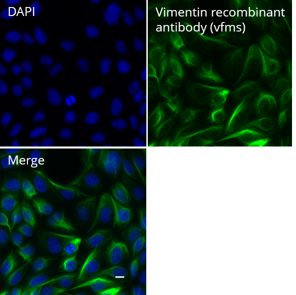 MDCK cells were immunostained with Vimentin recombinant antibody, VHH-mouse IgG1 Fc fusion [CTK0211] (vfms, 1;500) and Nano-Secondary® alpaca anti-mouse IgG1, recombinant VHH, Alexa Fluor® 647 [CTK0103, CTK0104] (sms1AF647-1, 1:500). Scale bar, 10 µM.