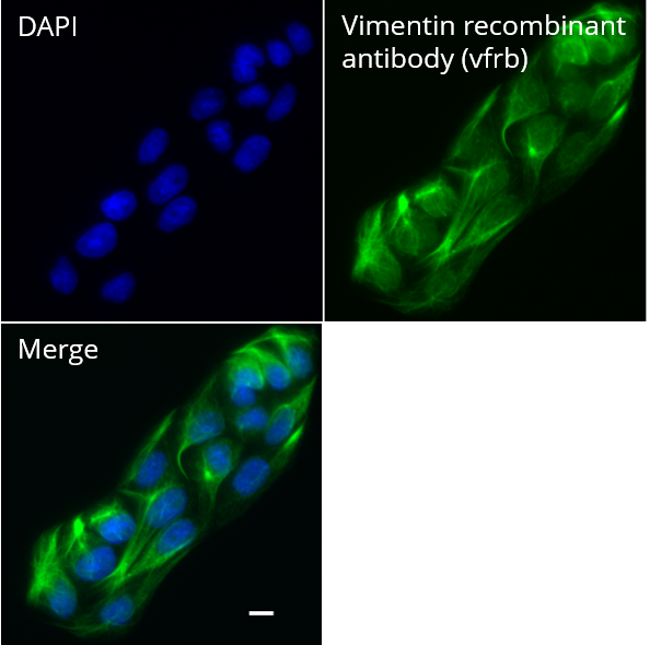 MDCK cells were immunostained with Vimentin recombinant antibody, VHH-rabbit IgG Fc fusion [CTK0211] (vfrb, 1:1,000) and Nano-Secondary® alpaca anti-human IgG/anti-rabbit IgG, recombinant VHH, Alexa Fluor® 647 [CTK0101, CTK0102] (srbAF647-1, 1:1,000). Scale bar, 10 µM.