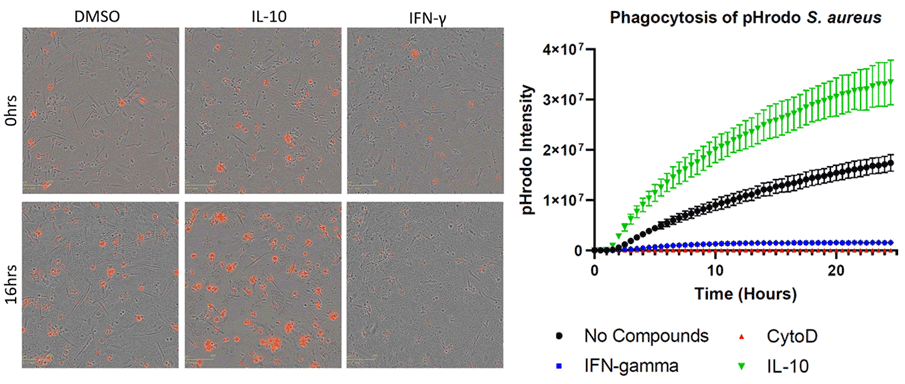 PHE_microglia_phagocytosis_assay_fig5.gif