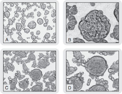 Cancer Stem Cell Media Premium™ gp10Ԕ|{ڒזE`ᇉ̌`Ԃ܂B  (A) MCF-7iqgRזEjtumorspheresC|{8  (B) MCF-7@tumorspheres@gʐ^C|{8  (C) PLC/PRF/5iqg̊RזEjtumorspheres, |{8  (D) PLC/PRF/5 tumorspheres gʐ^C|{8