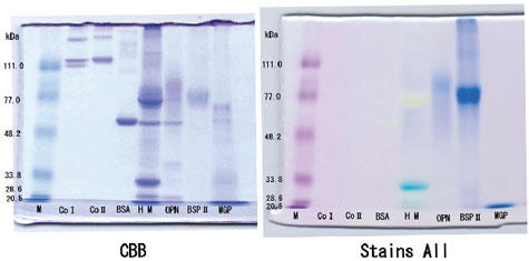 Staining example of acidic protein