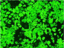 Observation of fat globules