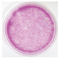 Staining of mineralized osteogenic culture kit cells