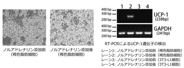 Figure 1 Activation of Uncoupling protein-1 (UCP-1)