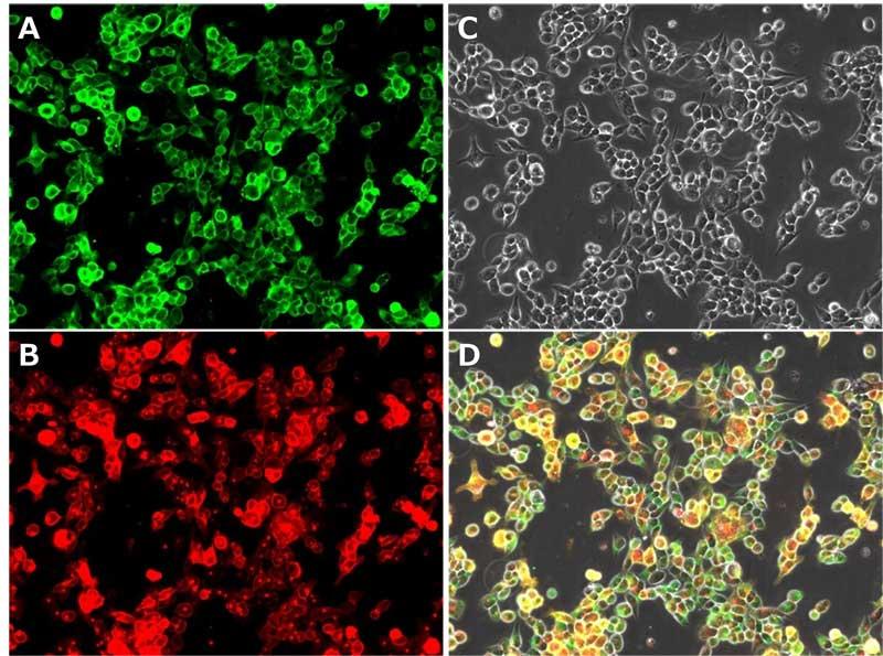 PMC_COV02C_fig1.jpg