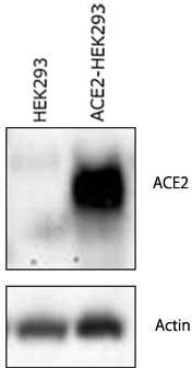 PMC_COV02C_fig2.jpg