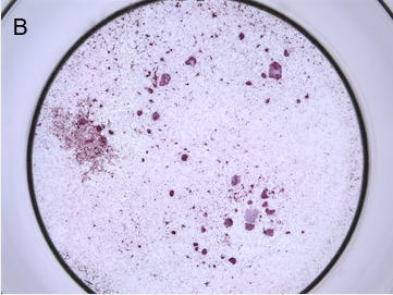 破骨細胞発色画像（代表例抜粋）：被験物質あり