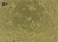 図1　M-CSF / RANKL で分化誘導した ヒト破骨細胞<br />（播種4 日目）