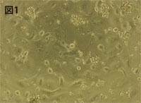 Figure 1 Human osteoclasts induced to differentiate with M-CSF/RANKL<br />(Day 4 of seeding)