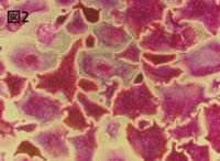 図2　TRAP 染色したヒト破骨細胞　