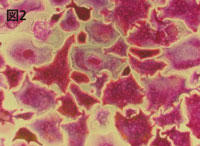 Figure 2 TRAP-stained human osteoclasts　