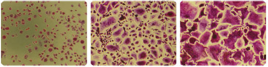 Figure 6 Osteoclast formation inhibition test by addition of β-estradiol