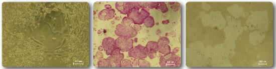 1. TRAP staining method