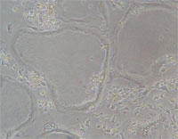 rat osteoclast