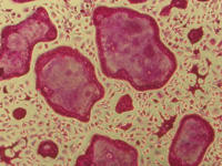 ラット破骨細胞のTRAP染色