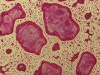 TRAP staining of rat osteoclasts