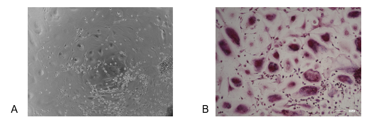 PMC_Osteoblast_service_02.png