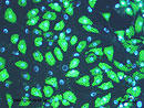 Adipocyte fluorescent staining kit