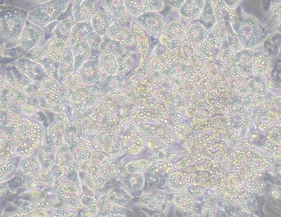 ラット内臓脂肪細胞