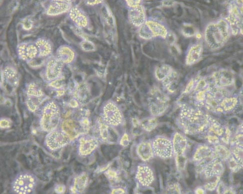 Mouse epididymal adipocytes