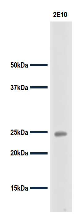 PPX_anti_s100a4_fig1.png