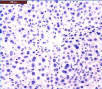 図1  マウス肝臓および腎臓の免疫組織化学染色（本抗体 0.5 μg/mL を使用） BSA を投与したマウス腎臓