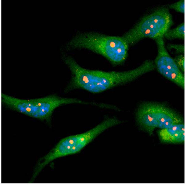 HeLa細胞を用いた細胞染色（RM231）