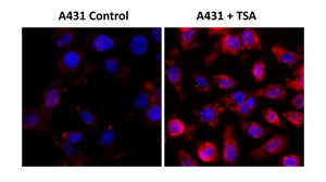 A431細胞の免疫組織化学
