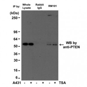 イムノグロブリンやヒストンを特異的に検出 RevMAb Biosciences社 ウサギモノクローナル抗体