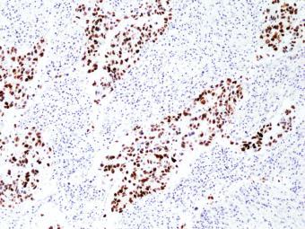 免疫組織染色