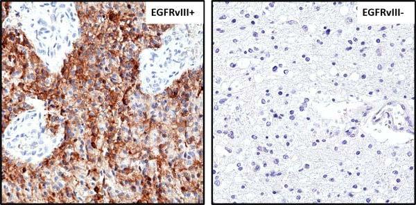 REV_braintumor_antibody_01