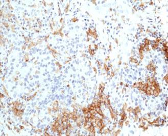 REV_immunooncology_antibody