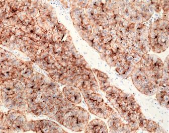 REV_immunooncology_antibody