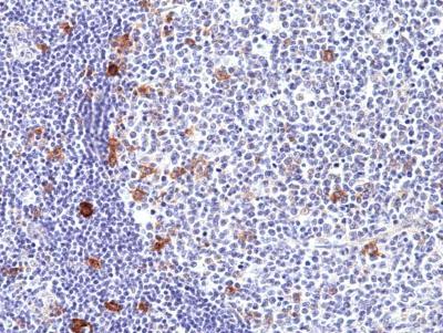 REV_immunooncology_antibody