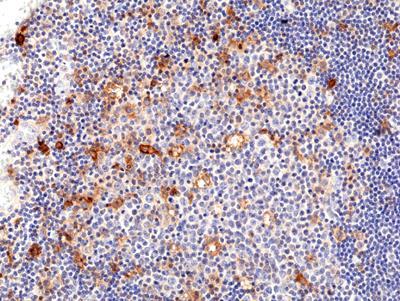 REV_immunooncology_antibody