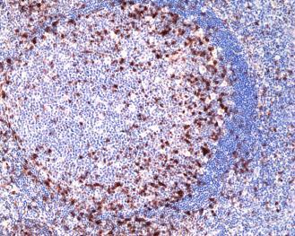 REV_immunooncology_antibody