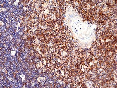 REV_immunooncology_antibody