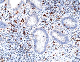 REV_immunooncology_antibody