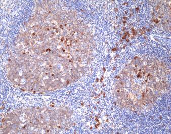 REV_immunooncology_antibody