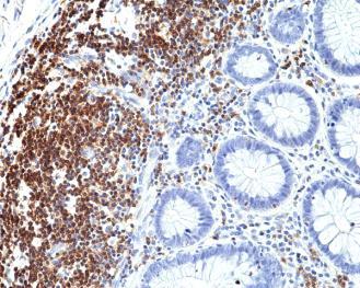 REV_immunooncology_antibody