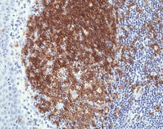 REV_immunooncology_antibody