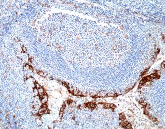 REV_immunooncology_antibody